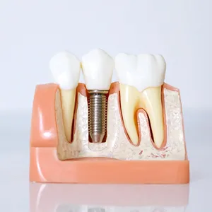 Can Emergency Dentists Perform Dental Implants?