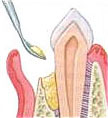 Periodontist Linden