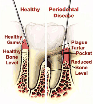 Periodontist Linden