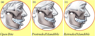 Oral Surgery Linden