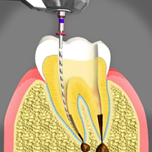 Endodontist Linden