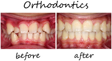 Orthodontics 1