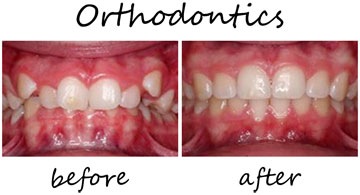 Orthodontics 2