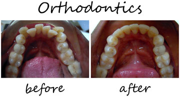 Orthodontics 5